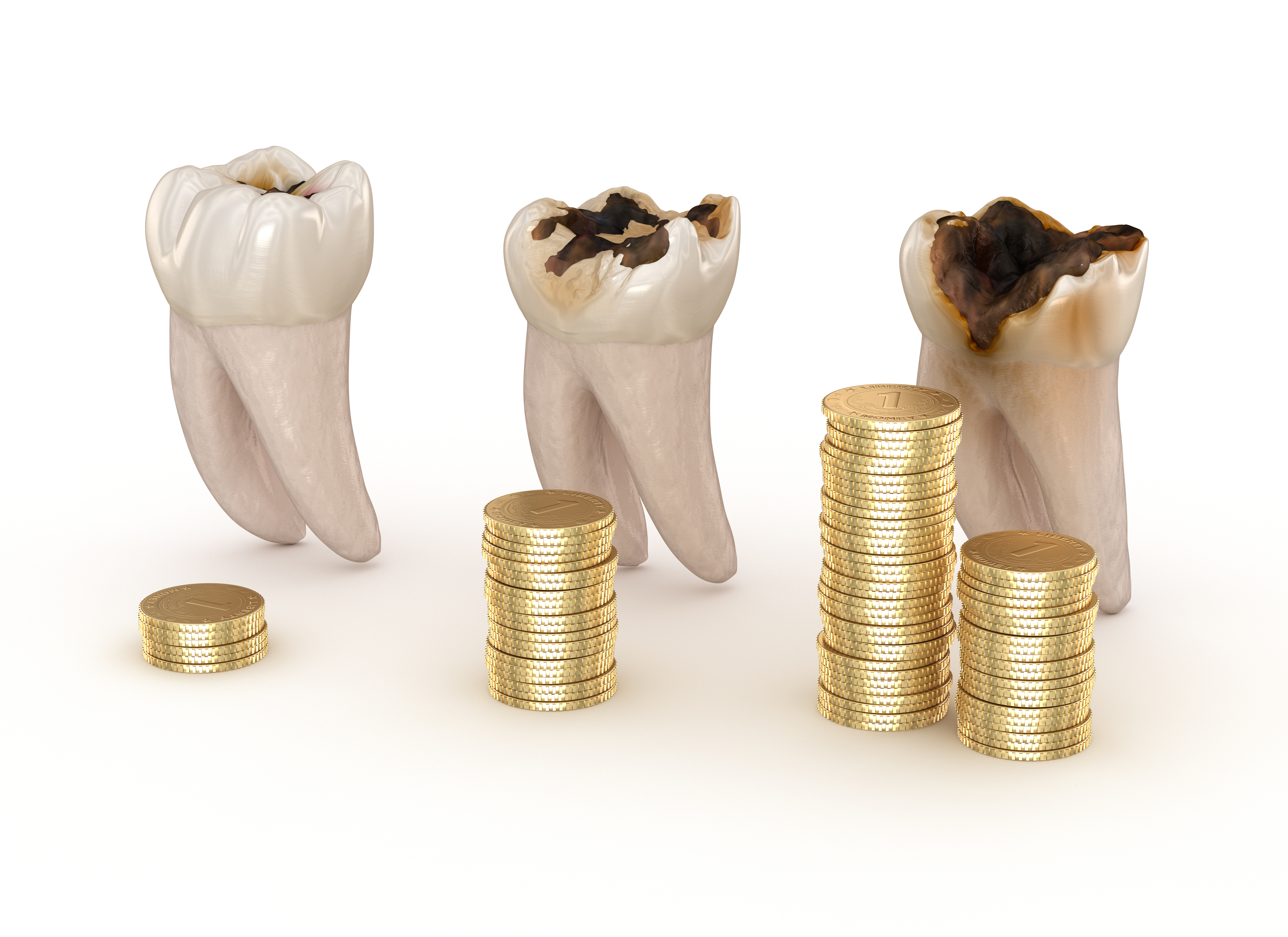 Dental cost help - Instasmile Dental cost help - Instasmile