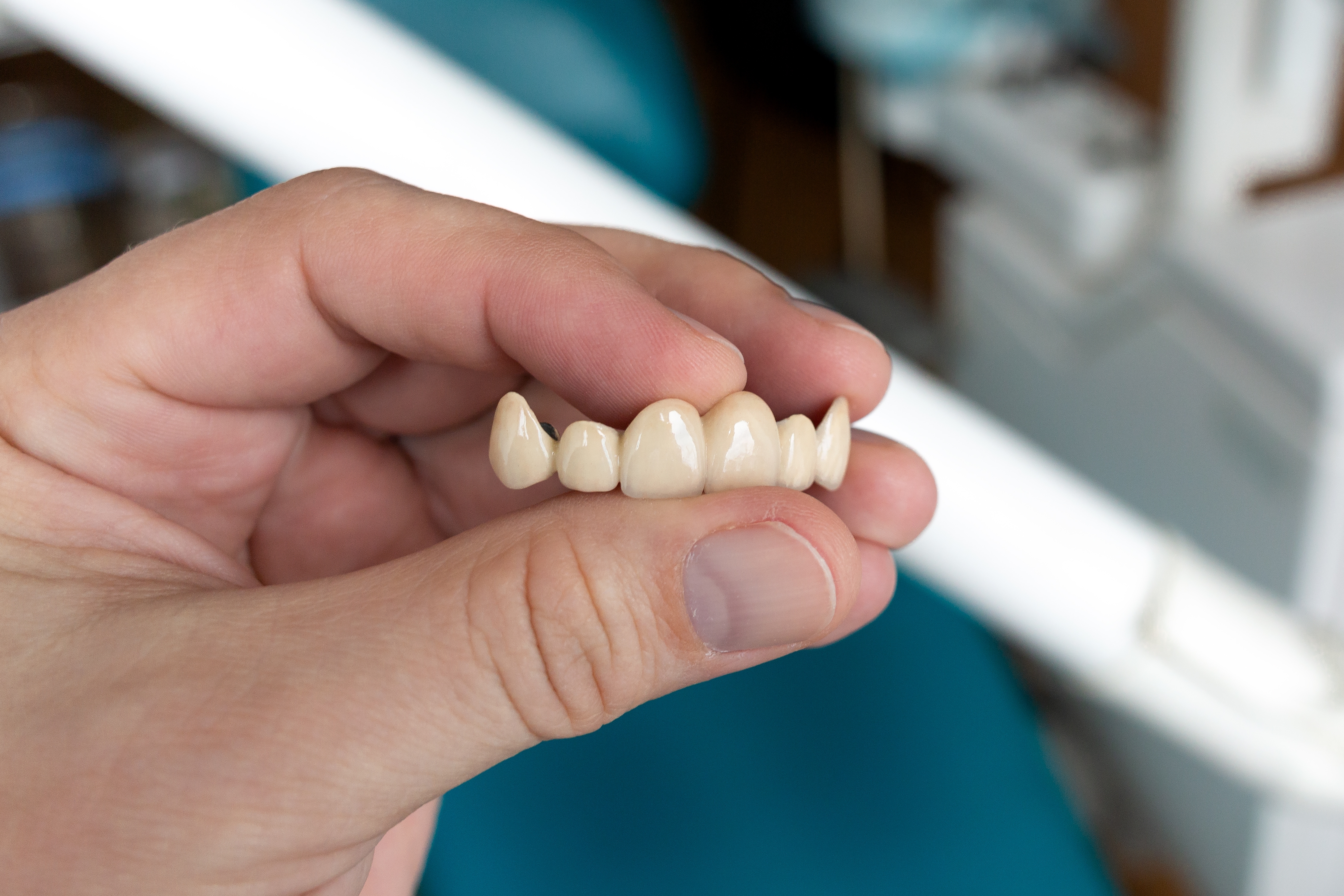 Difference between dental implants and dentures