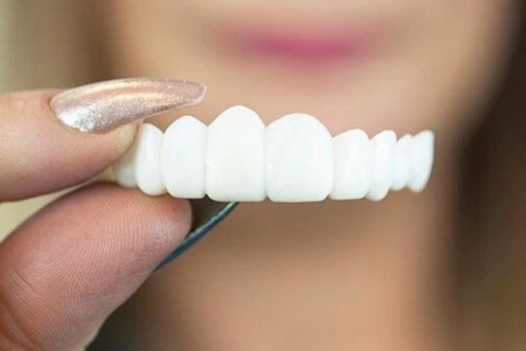 Perfect teeth and perfect smile - instasmile Perfect teeth and perfect smile - instasmile