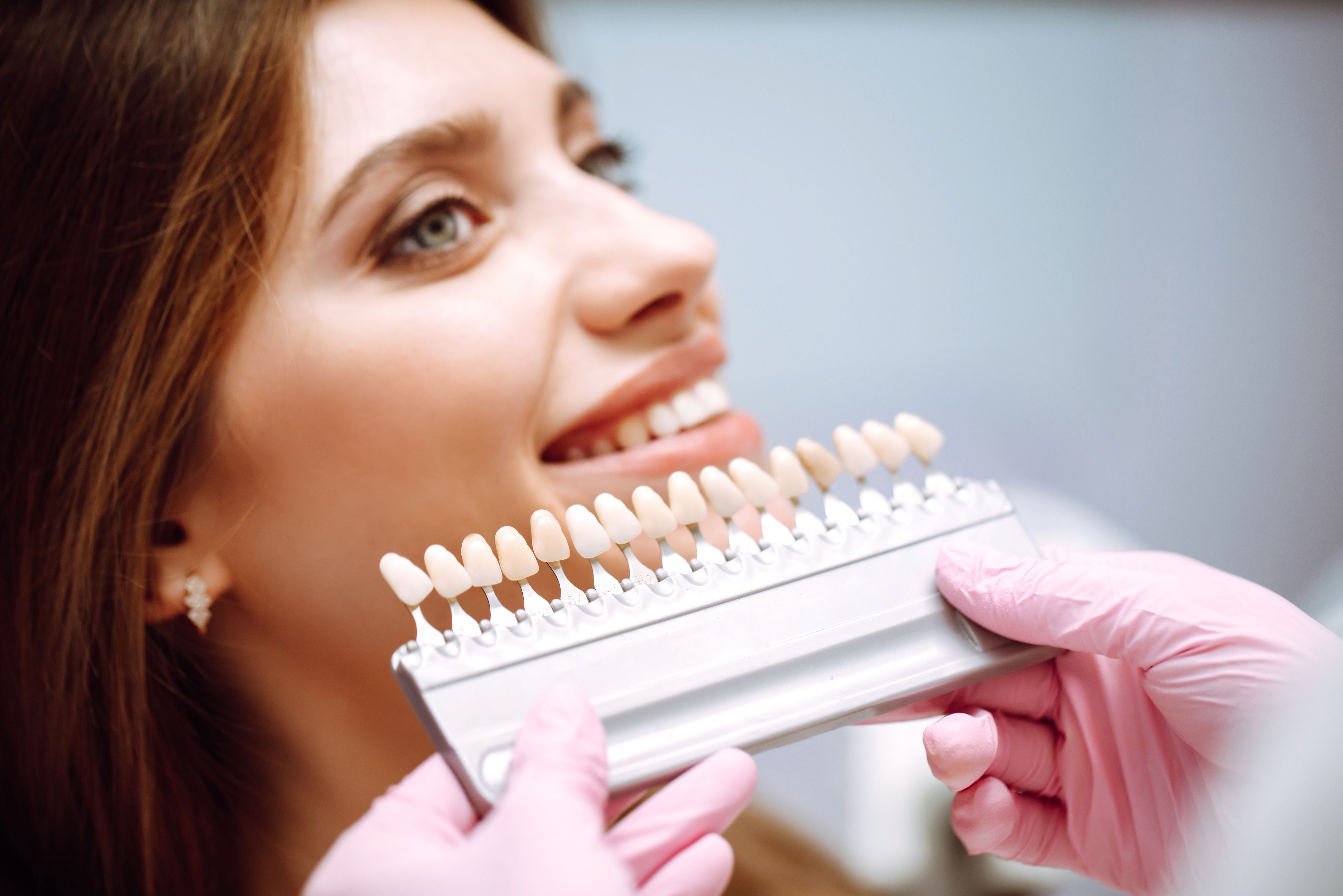How to get affordable dental veneers