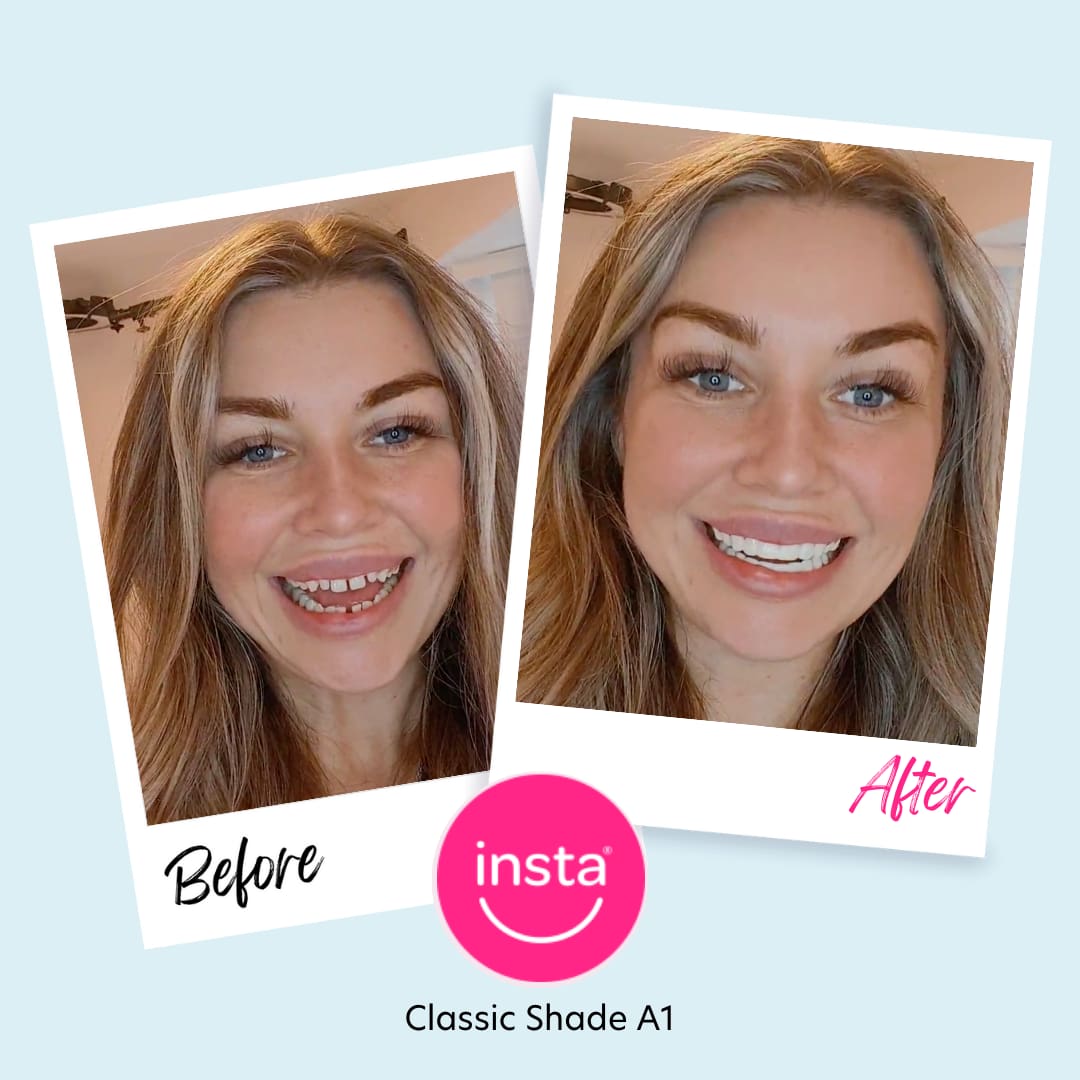 How to hide your smile - Instasmile US How to hide your smile - Instasmile US