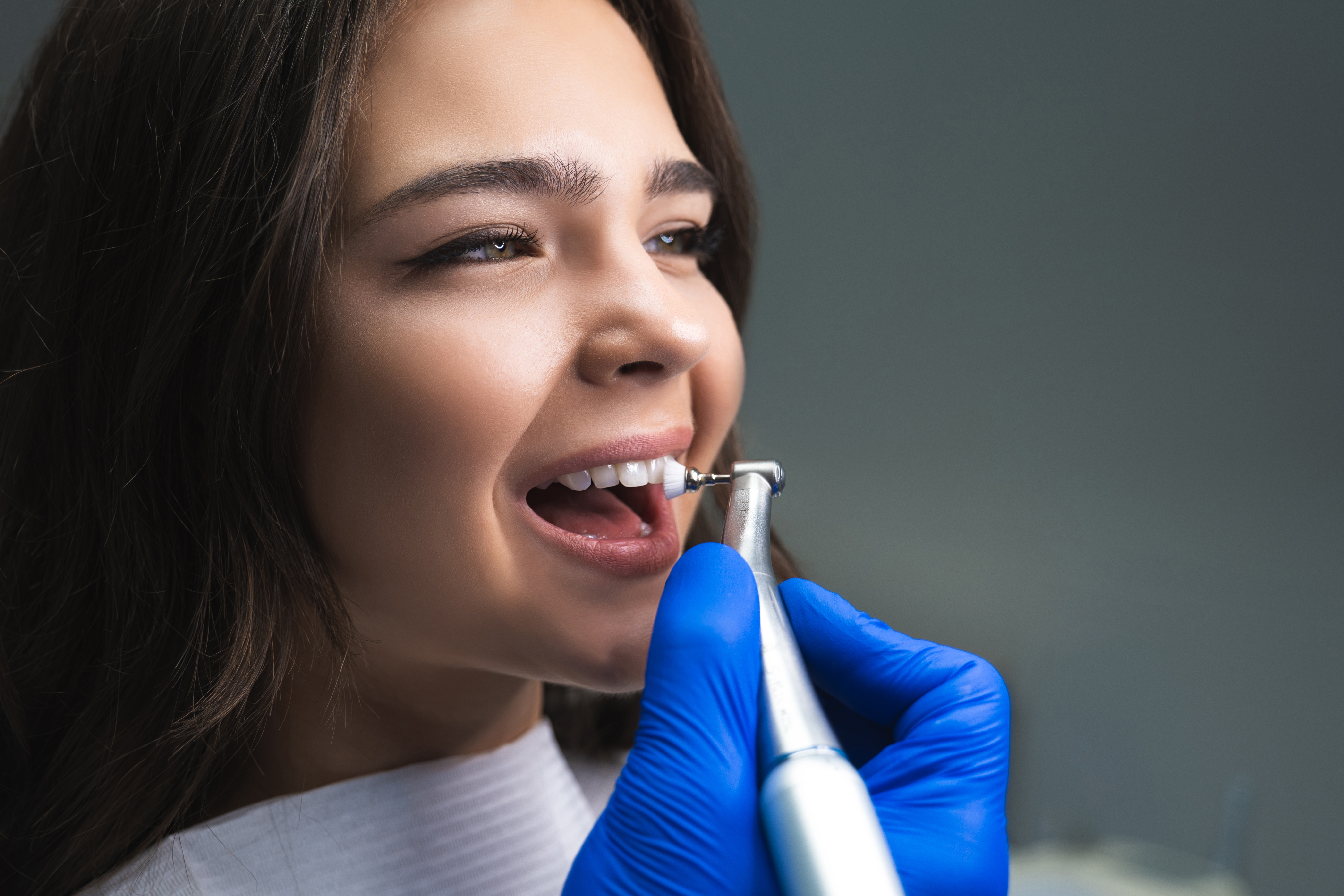 Veneers aftercare - instasmile